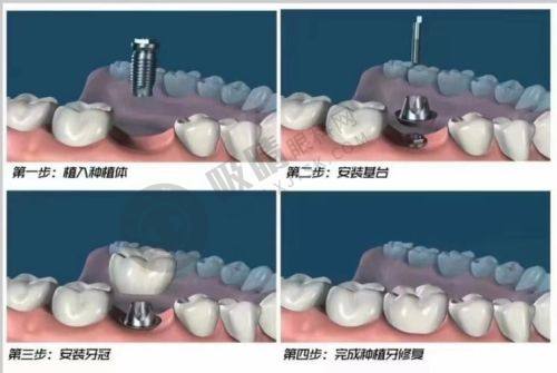 6. 患者对郑州德韩口腔评价怎么样？