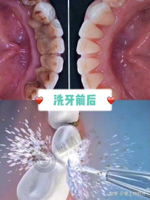 郑州拜尔口腔医院怎么样？20张牙椅、3D导板种植、儿童诊室，金水区看牙首选！