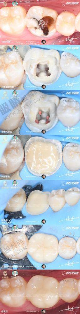3. 郑州植得口腔医院的技术和设备怎么样？