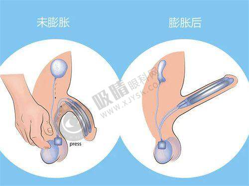 4. 深圳韩秀医疗美容门诊部的环境和服务怎么样?