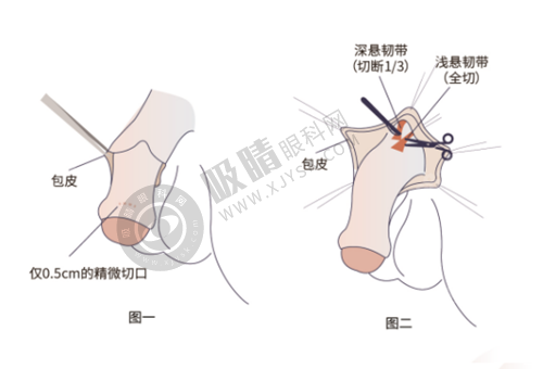 探秘武汉美莱医院总结