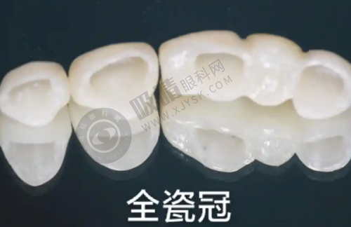 4. 广东湛江赤坎兴华口腔医院特色项目