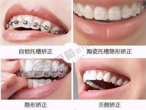 4. 广州南沙诚飞港大口腔的服务怎么样?