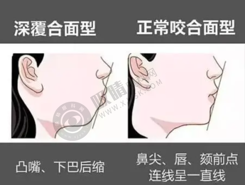 4. 东莞莞城美利汇峰口腔的收费情况如何?