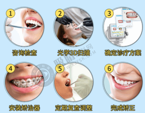 云浮口腔医院口碑怎么样？顾客好评！即刻种植5分钟完成+8大国际种植体品牌任选！