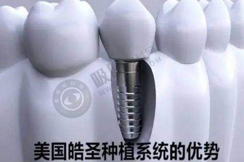 常熟牙博士口腔医院价格表之种植牙优惠套餐