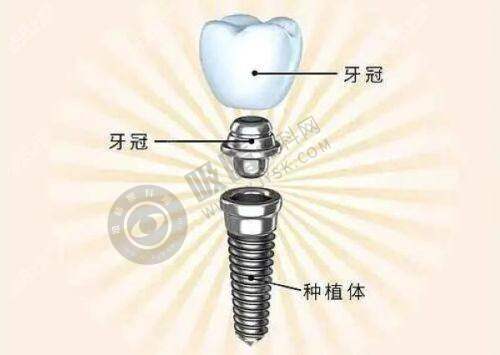 4. 东莞南城众芽口腔门诊部收费价格贵吗?