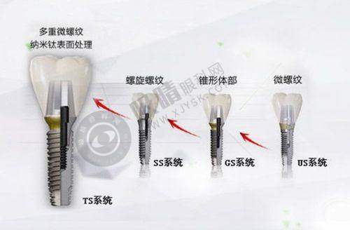 4. 广州瑞华口腔门诊部医院特色项目
