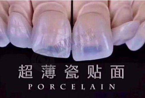 常熟牙博士口腔医院口腔外科项目参考价格揭秘
