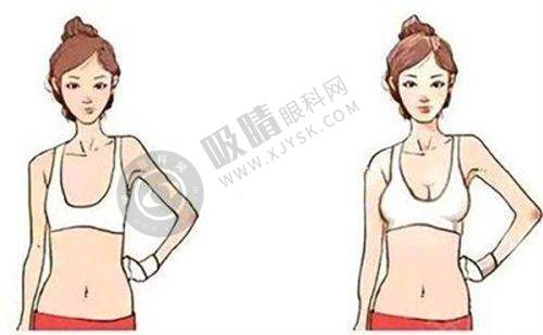 东莞西妃整形医院正规靠谱吗？鼻综合+脂肪填充实力解析，南城医美口碑之选！