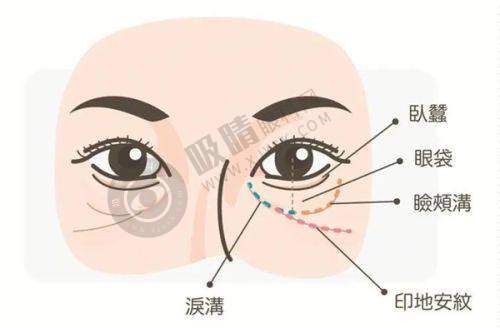 深圳鸿瑞（西晶）整形靠谱吗？鼻修复4万起+张辉院长亲诊，德国设备保障安全塑美！