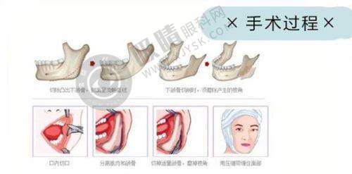 2. 东莞美立方医美能开展哪些项目?