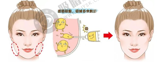 东莞美立方医美的技术和设备有什么优势?