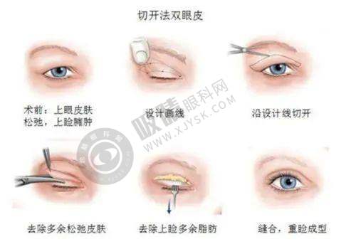4. 中山爱思特美容医院的价格是否合理?