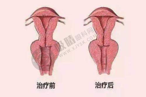 广州军美整形医院的收费情况怎样?