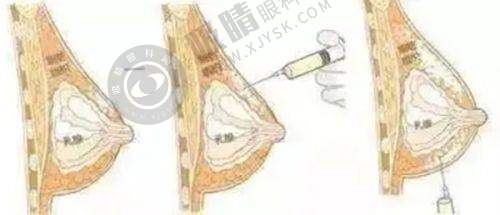 2. 中山美南华美容医院的医生团队如何?