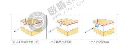 4. 中山美南华美容医院的口碑和评价怎么样?