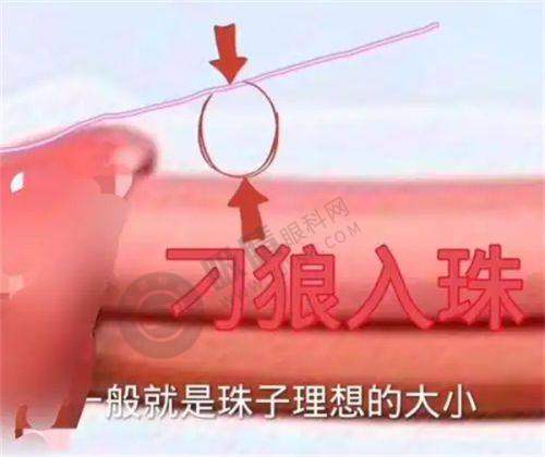 5. 广东中山爱思特美容医院价格