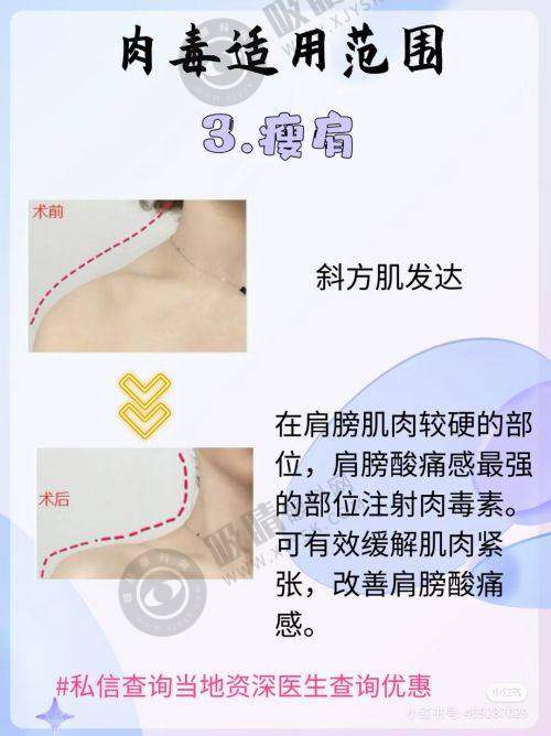 4. 中山爱思特美容医院的医护团队怎么样?