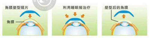 4. 精良的设备运用