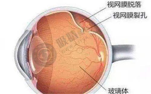 九江爱尔眼科医院做近视手术好吗