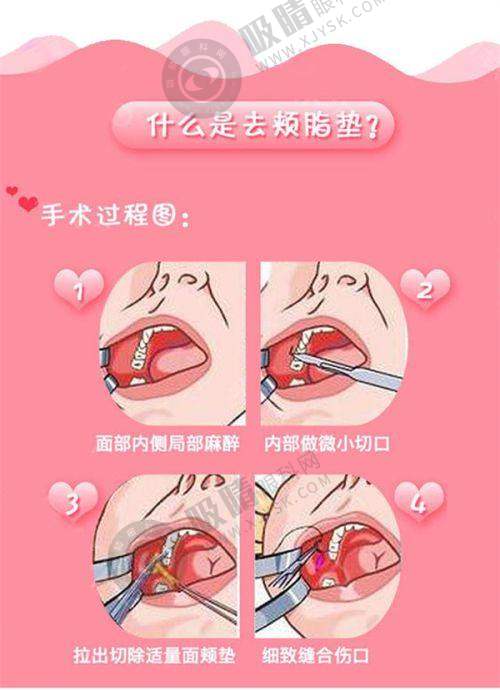 3. 佛山佳丽整形的整体实力如何?