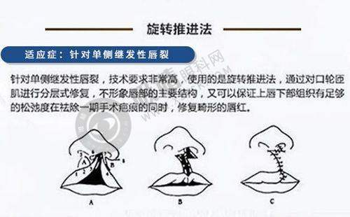 4. 价格合理，满足多样需求