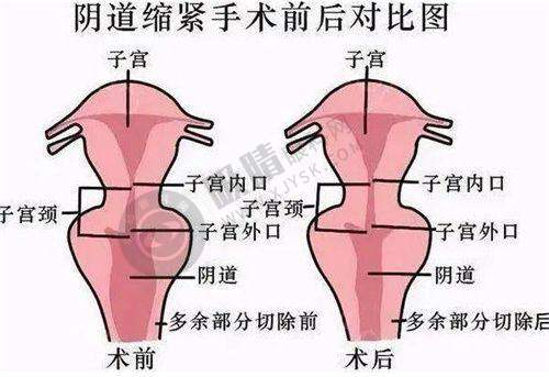 4. 南阳第三医院整形科——小切口缝合技术与自然手术成效