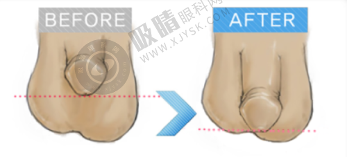 10. 郑州铭艺整形——吸脂修复口碑佳