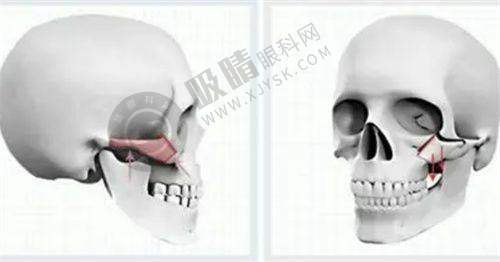 杭州艺星做双眼皮之医生比较