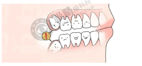 结尾