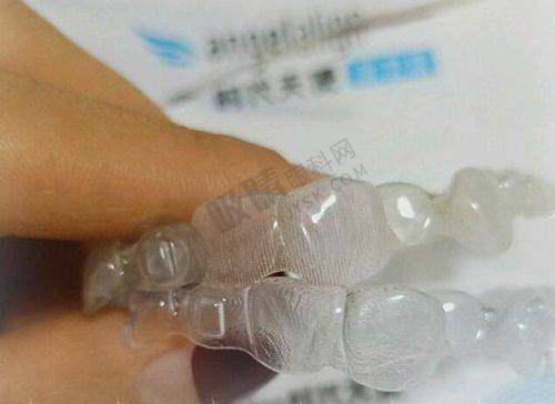 厦门麦芽口腔医院特色擅长技术