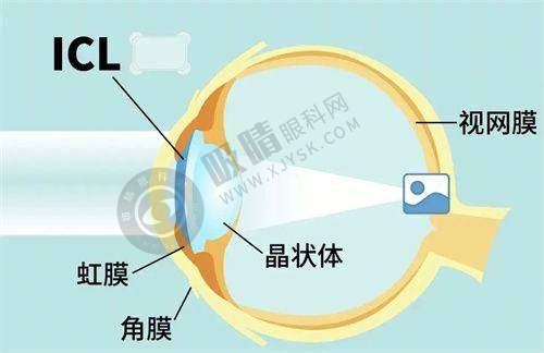 苏州光明眼科医院靠谱吗？专业医生团队、先进设备，近视手术低至7800元起！