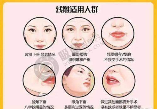 三、长春植发项目收费情况