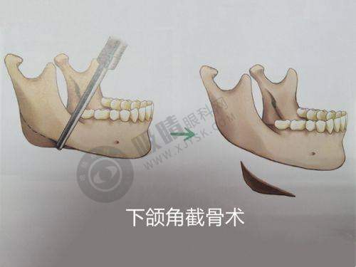 汉中韩美整形医院——汉中老牌正规整形医院