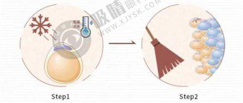 2025合肥整形哪家强？十大正规医院+王牌医生全解析，避坑指南来了！