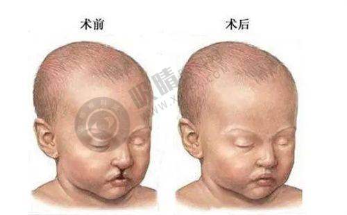 三、上海隆胸项目收费情况