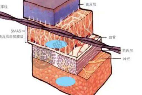 三、阳泉地区整形项目收费情况