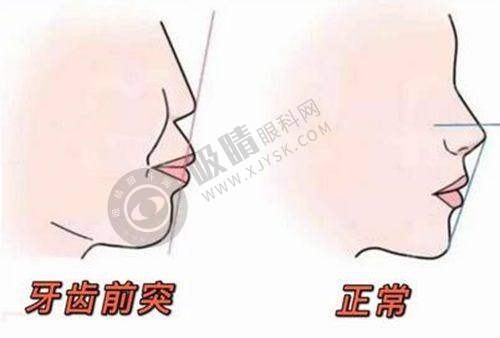 2. 成都圣贝口腔:拥有多种正畸选择的三等级口腔专科医院