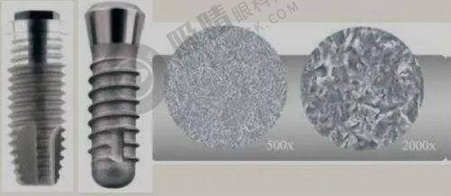 三、成都牙齿矫正项目收费情况