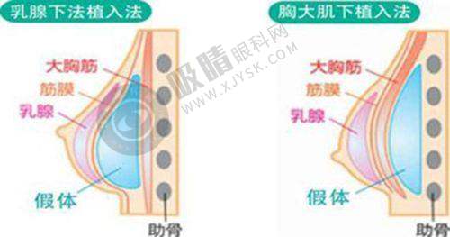 4. 北京丰联丽格医疗美容医院特色项目