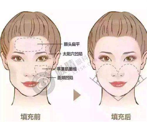 4. 北京丰科星范医疗美容门诊医院特色项目