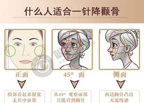 三、西安整形项目收费情况