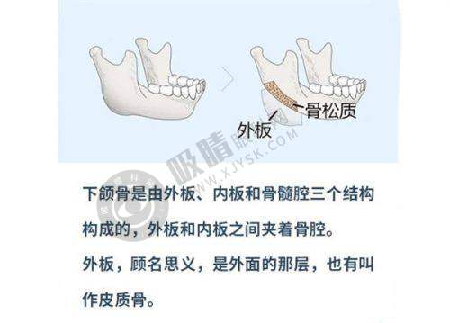 2. 碧莲盛植发：不剃发技术先锋