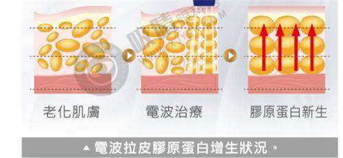 3. 西安米兰柏羽医疗美容医院——眼部与胸部整形口碑之选
