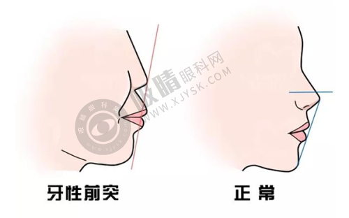 三、泰国变性手术项目收费情况