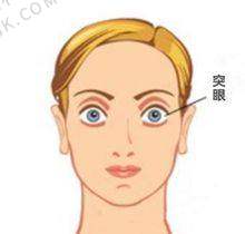 普瑞眼科 - 上市连锁的高性价比眼科医院