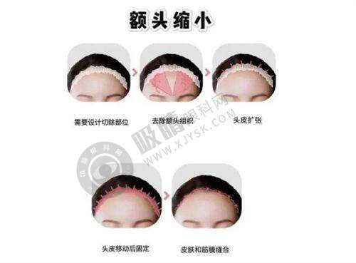 2. 排名第二：南京美莱——个性化定制与精良评估结合