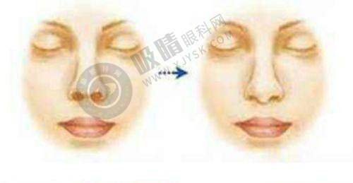 3. 第三名:西宁韩美整形美容医院——专精整形机构,多样祛疤服务
