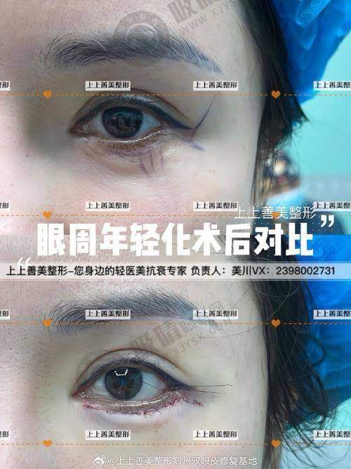 5. 排名第五：东部战区总医院整形美容科——专精严谨的部队医院科室